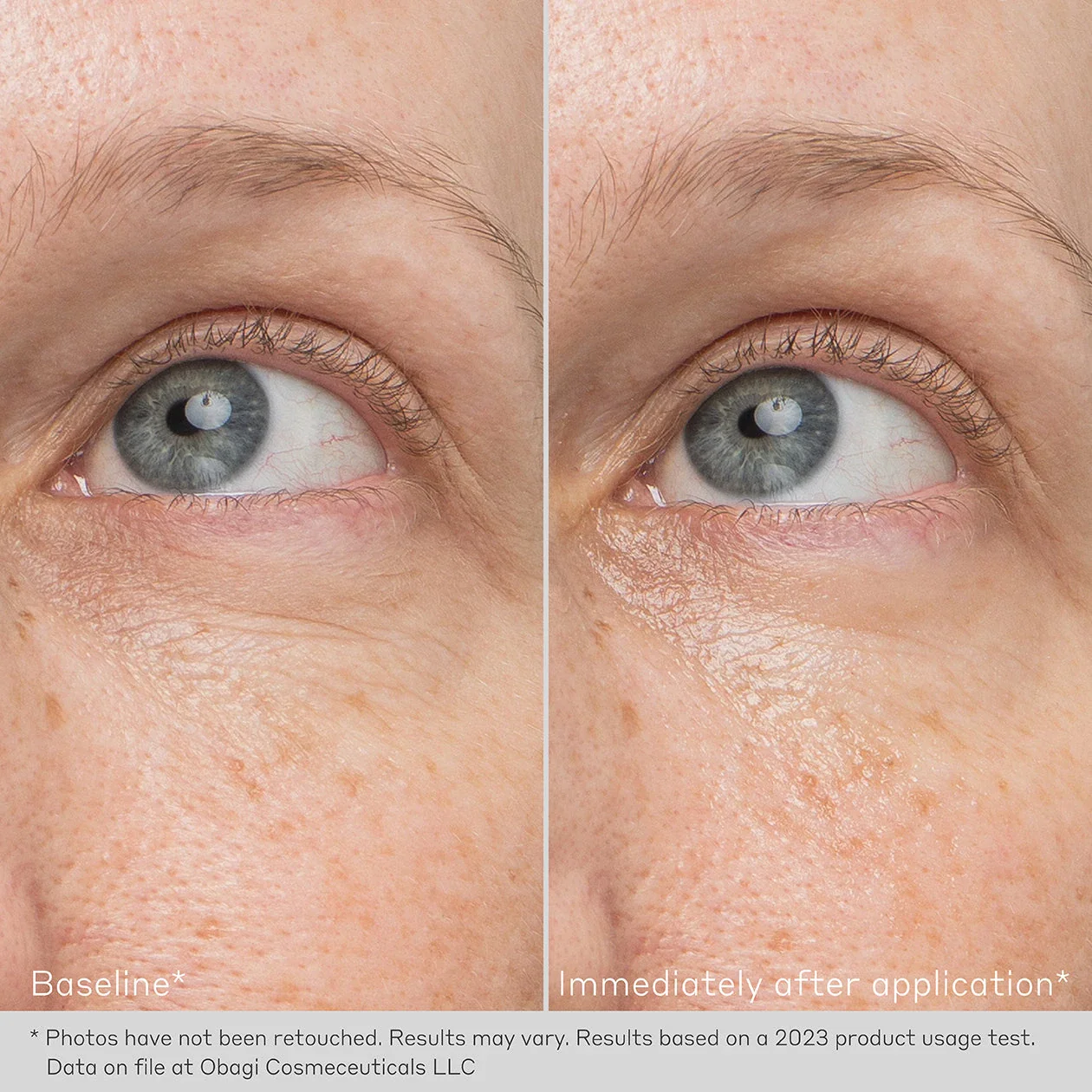 OB-DHD-EYE-BEFORE-AND-AFTER-1260X1260-009_5_1_1920x