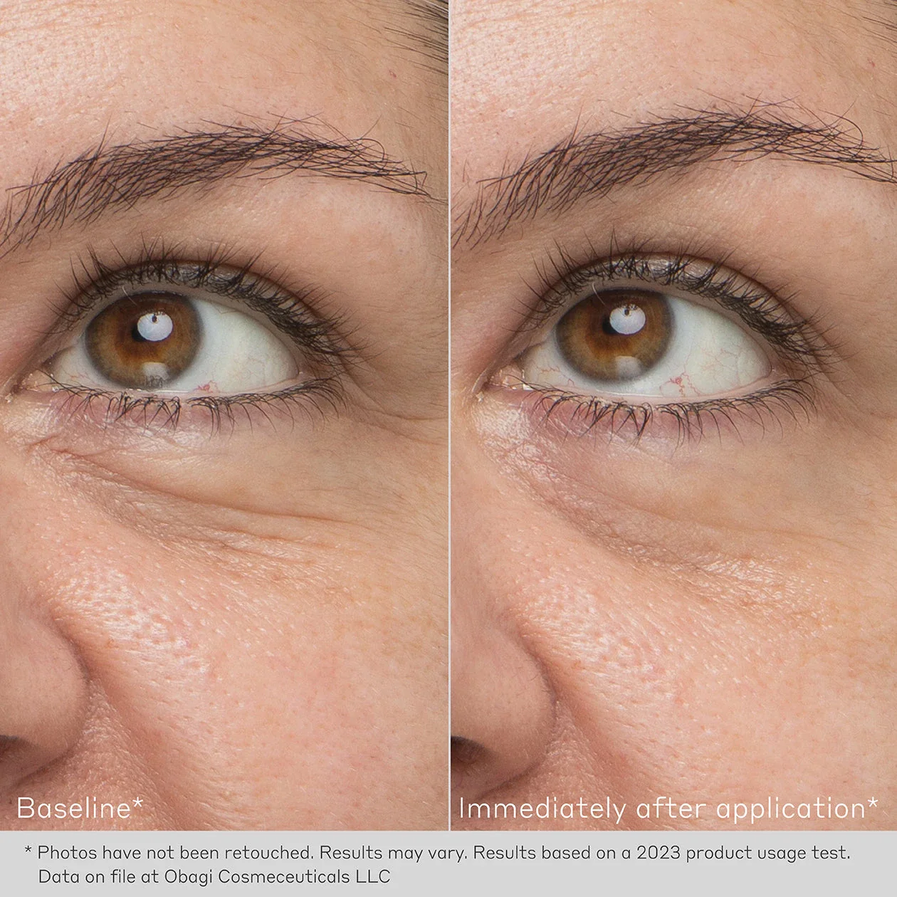 OB-DHD-EYE-BEFORE-AND-AFTER-1260X1260-013_2_1_1920x